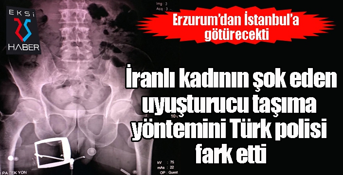 İranlı kadının şok eden uyuşturucu taşıma yöntemini Türk polisi fark etti