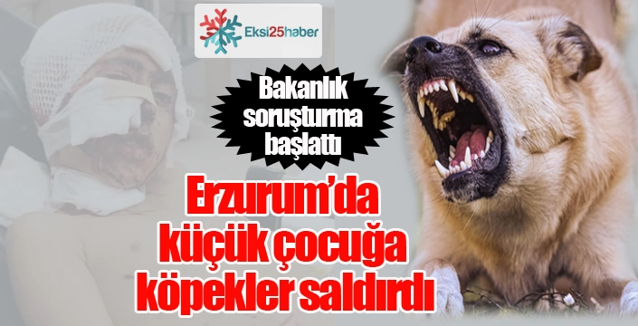 Erzurum'da köpeklerin saldırdığı çocuk tedavi altında...
